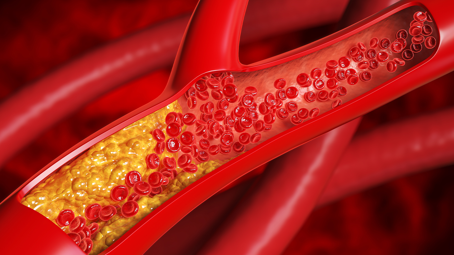 cholesterol